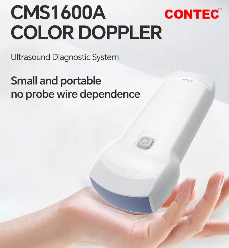 CONTEC CMS1600A 3 in 1 Wireless Ultrasound Scanner Machine Color Doppler Vascular WLAN Ultrasonic Diagnostic Systems